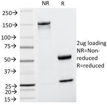 Cyclin D1 Antibody [CCND1/809]