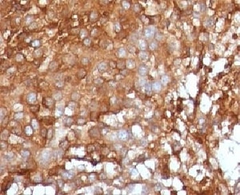 Beta-2 Microglobulin Antibody [B2M/961]