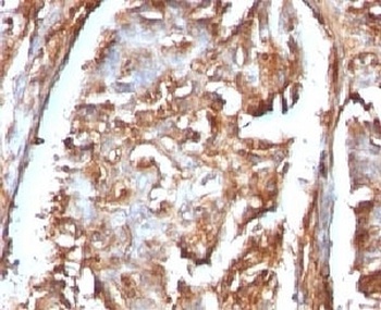 Beta-2 Microglobulin Antibody [B2M/961]