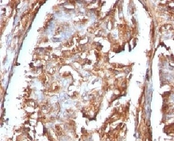 B2M Antibody