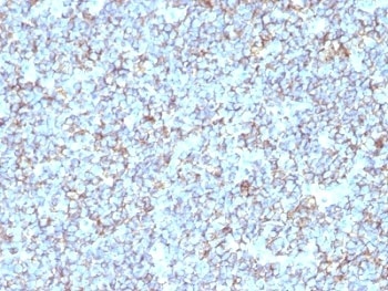 CD99 Antibody