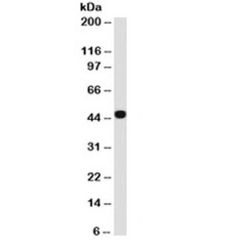 KRT18 Antibody