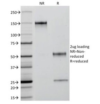 KRT18 Antibody