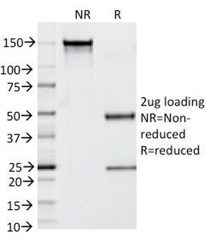 KLK3 Antibody