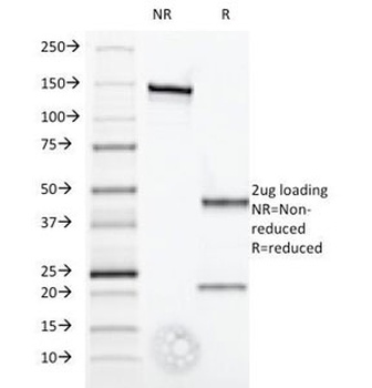 IFNA1 Antibody