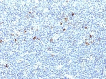 HLA-A Antibody