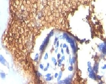 Glycophorin A Antibody [GYPA/280]