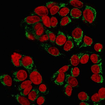 GnRH Receptor Antibody [GNRHR/768]