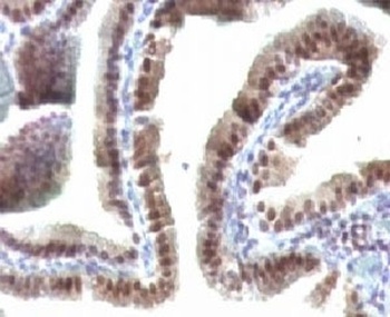 TOX3 Antibody