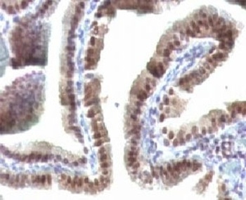 TOX3 Antibody [TOX3/1123]
