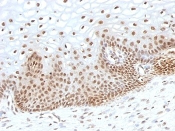 TOX3 Antibody [TOX3/1123]