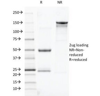 TOX3 Antibody