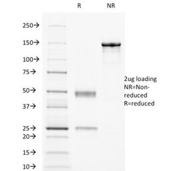 FCGR2A Antibody
