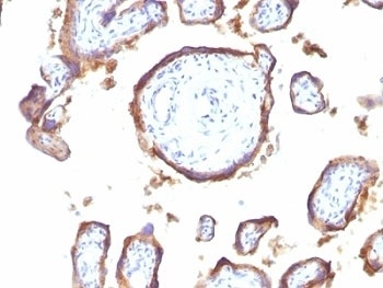EGFR Antibody [GFR1195]