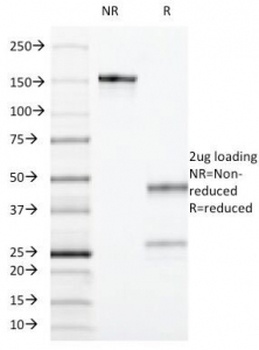 CD55 Antibody