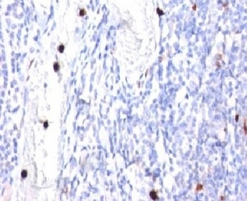 CSF3 Antibody