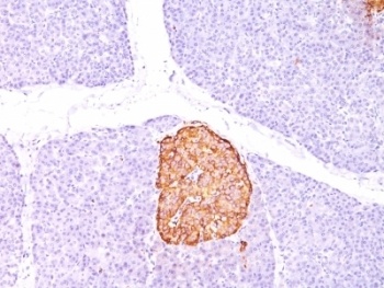 Chromogranin A Antibody [CHGA/798]