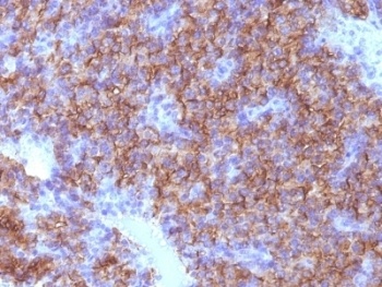 Chromogranin A Antibody [CHGA/798]