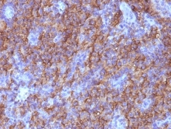 Chromogranin A Antibody [CHGA/765]