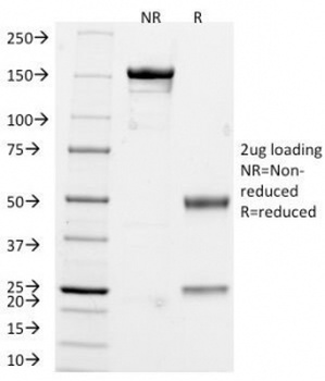 Chromogranin A Antibody [CHGA/765]