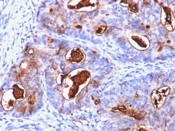 CEA Antibody [C66/1260]