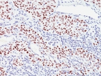 CDKN1C Antibody