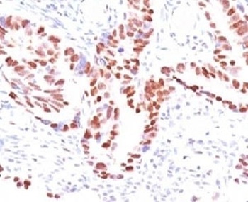 CDKN1C Antibody