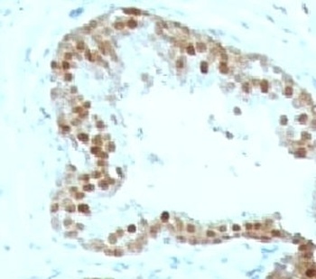 CDKN1C Antibody