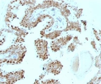 CDKN1C Antibody
