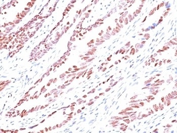 CDKN1C Antibody