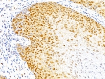 CDKN1B Antibody