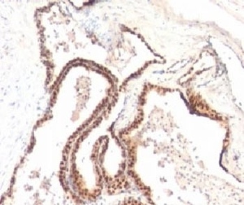 CDKN1B Antibody