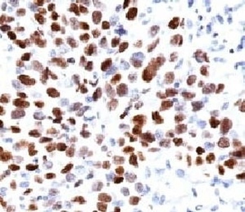 CDKN1A Antibody