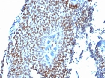 CDKN1A Antibody