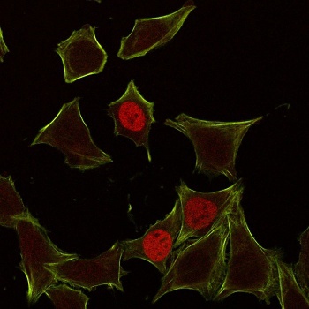 CDKN1A Antibody