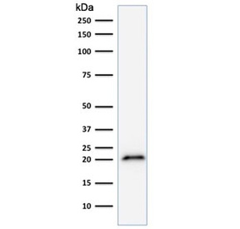CDKN1A Antibody