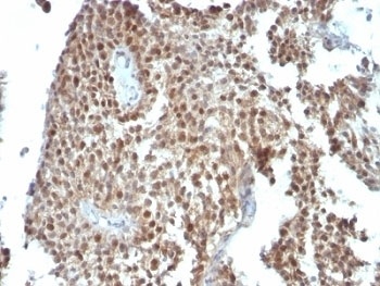 CDKN1A Antibody