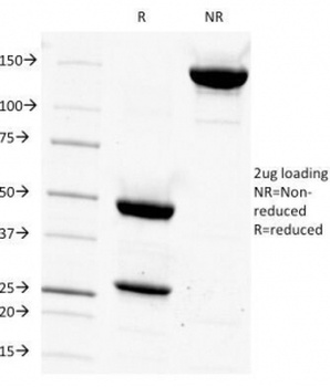 CD14 Antibody