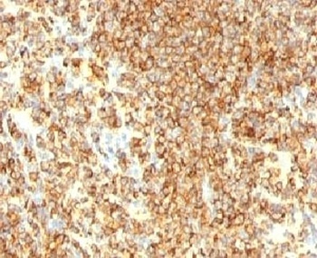 MS4A1 Antibody