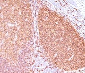 MS4A1 Antibody