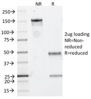 MS4A1 Antibody