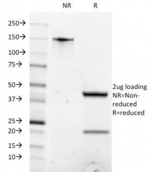 CD8A Antibody