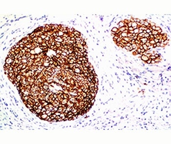 Her2 Antibody