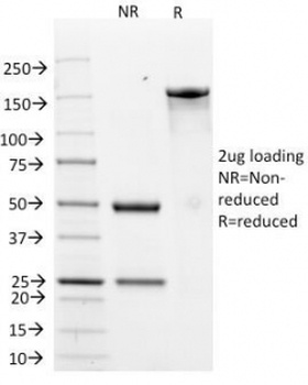 Her2 Antibody