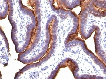 EMA Antibody [MUC1/520]
