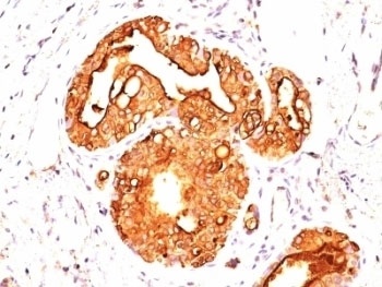 MUC1 Antibody