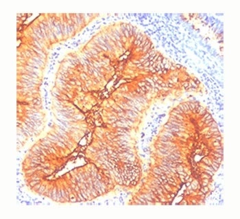 TAG-72 Antibody [CA72/733]
