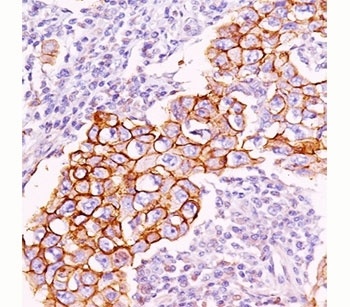 Phosphotyrosine Antibody [PY20]