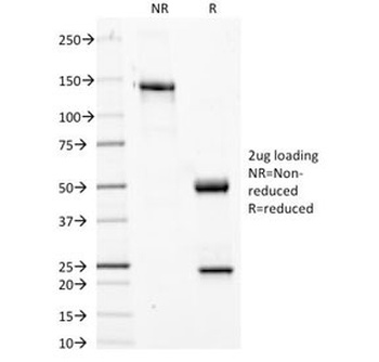Phosphotyrosine Antibody [PY20]