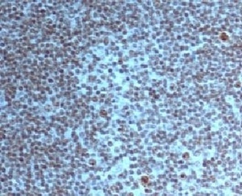 Nucleoli Marker Antibody [NM95]